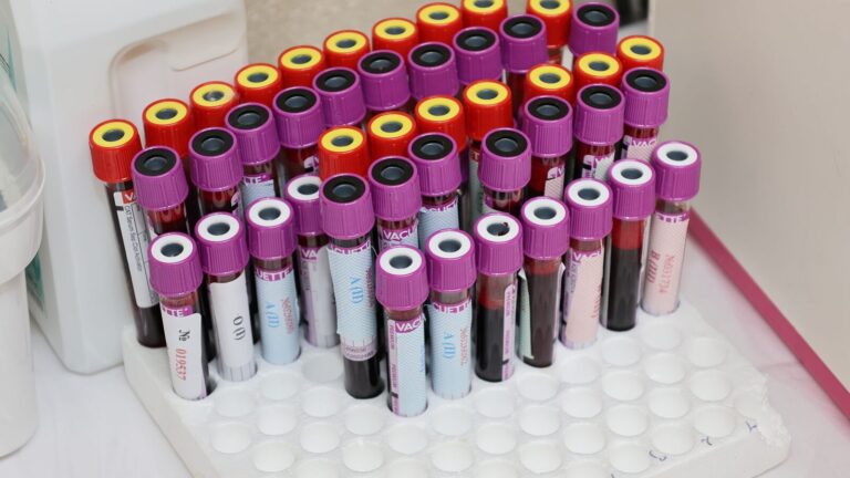 Portoir de tubes de prélèvement sanguin dans un laboratoire d'analyses