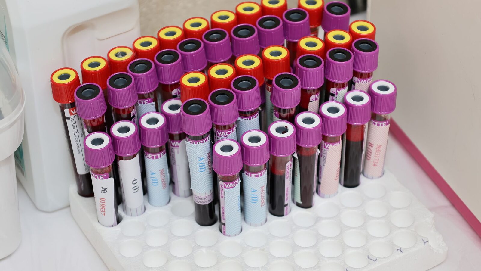 Portoir de tubes de prélèvement sanguin dans un laboratoire d'analyses